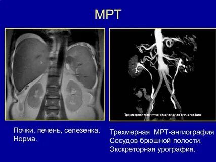 Мрт печень почка
