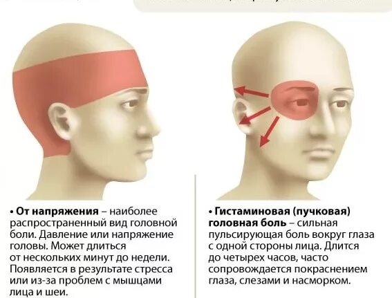 Давящие боли в области глаза. Головная боль с левой стороны. Болит голова левая часть головы. Болит голова левая сторона лба. Болит голова в левой части.