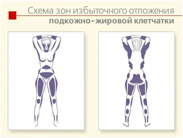 После миостимуляции жировой слой живота стал мягким - фото презентация
