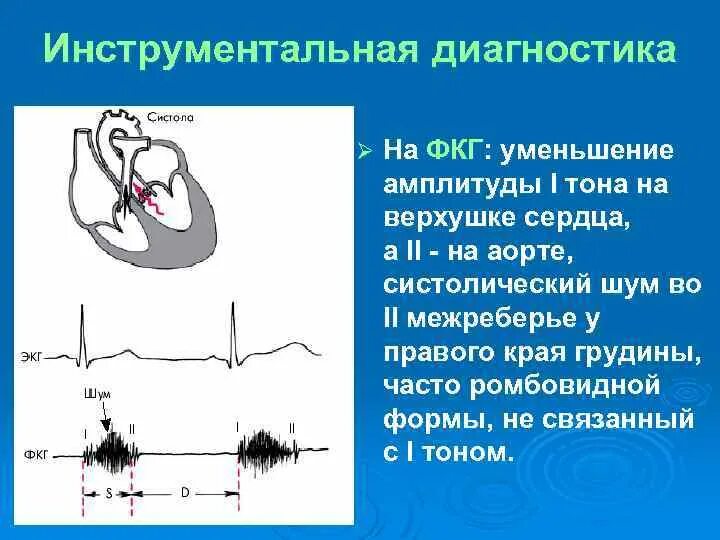 Структура 1 тона на ФКГ обусловлена. Систолический шум на основании сердца. Систолический шум у основания грудины. Систолический шум на ФКГ. Систолический шум это