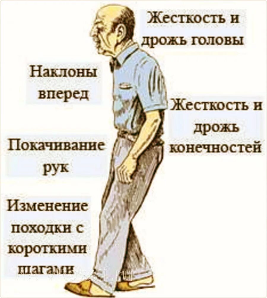 Болезнь Паркинсона. Паркинсон. Симптомы Паркинсона. Болезнь Паркинсона проявления. Что такое болезнь паркинсона простыми словами симптомы