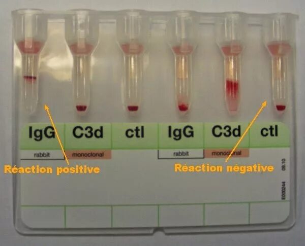 Тест постоянный ток 8 класс. Coombs Test. DG Gel Coombs.