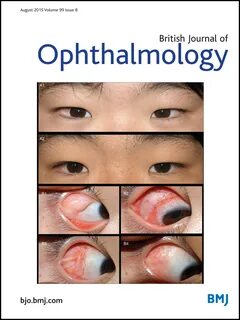 Ophthalmology journal