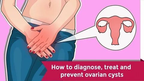 Ovarian Cysts, How ovarian cysts are diagnosed and treated, How To Treat Ov...