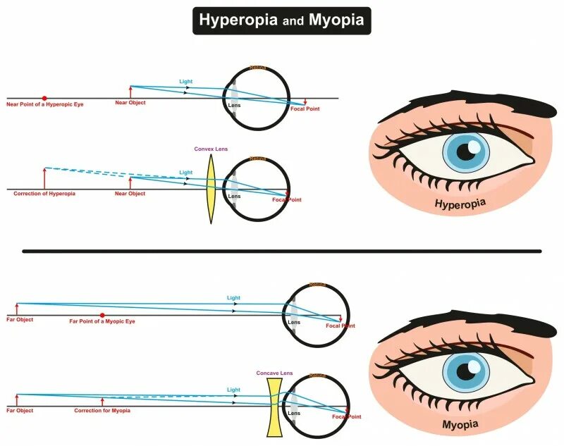 Eye point