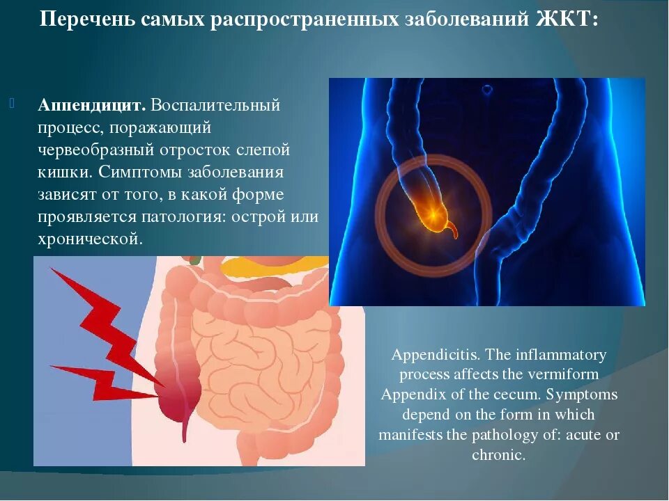 Желудочно кишечные проявления