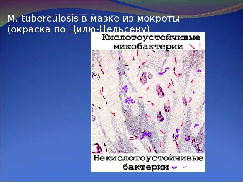 Мокрота окраска. Кислотоустойчивые микобактерии туберкулеза. Микобактерии туберкулеза мазок. Микобактерии кислотоустойчивые бактерии. Окраска мазка микобактерии туберкулеза.