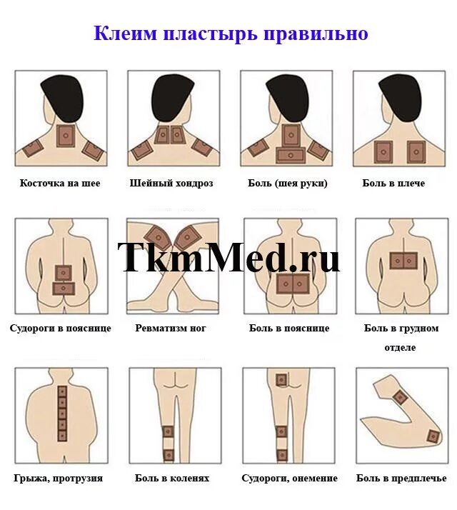 Куда клеить перцовый пластырь. Перцовый пластырь клеит. Пластырь при кашле. Куда можно клеить перцовый пластырь. Горчичным при кашле