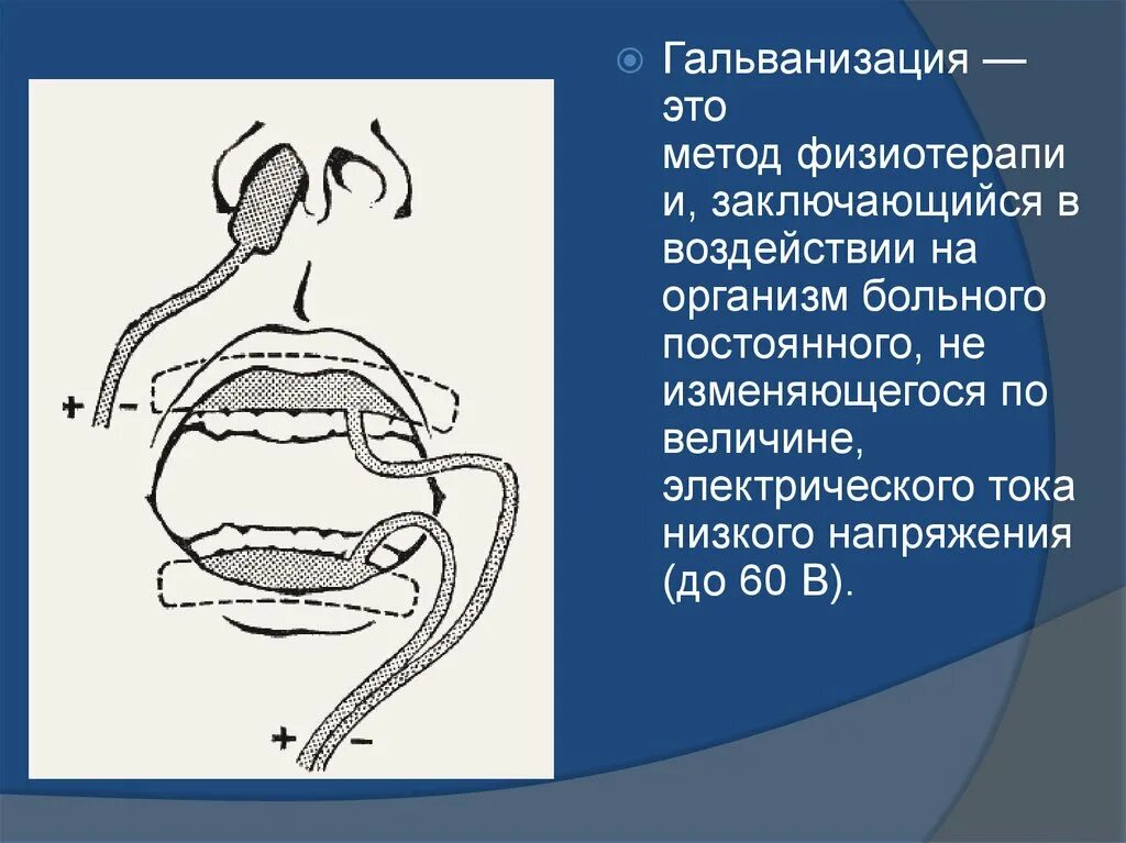 Гальванизм в полости рта. Гальванизация электрофорез в стоматологии методика. Гальванизация полости рта. Гальванические явления в ротовой полости.