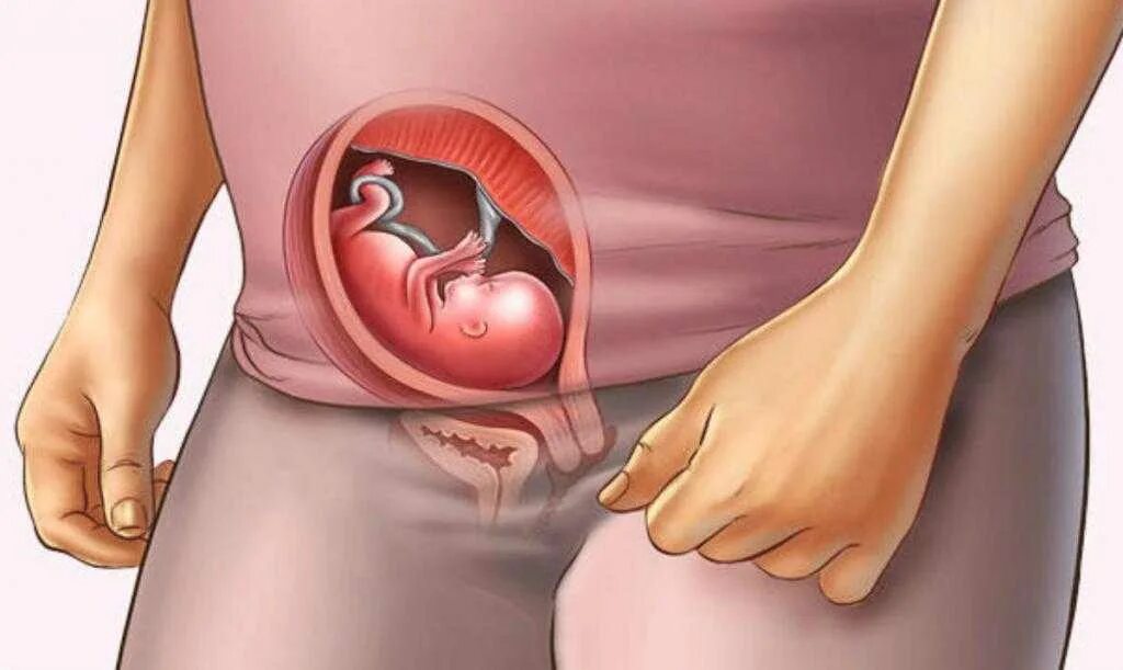14 неделя б. 15 Акушерская неделя беременности. 15 Недель беременности фото плода. Расположение малыша на 15 неделе беременности. Малыш в животе 15 недель.