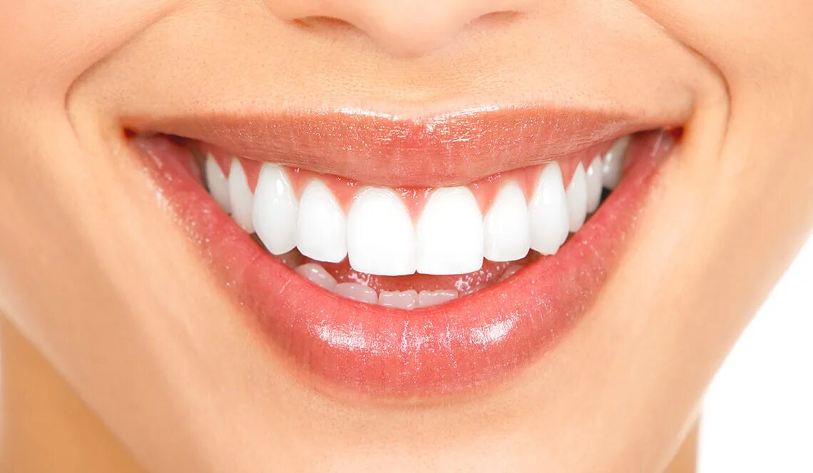 Cupped teeth. Красивые ровные зубы. Cupped teeth. Cupped teeth. Красивая улыбка.