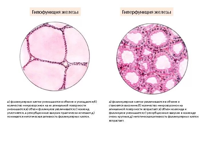 Гиперфункция щитовидной железы гистология препарат. Строение щитовидной железы гистология. Щитовидная железа гистология препарат. Строение щитовидной железы гистология препарат.