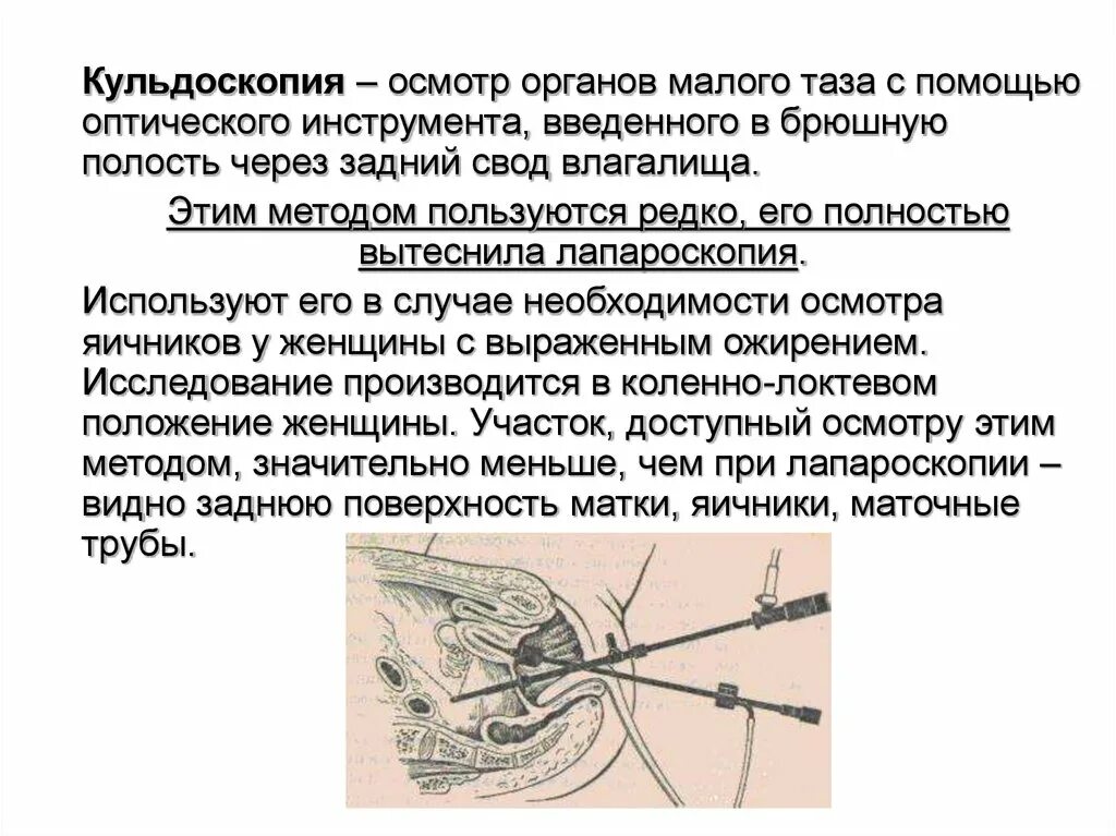 Лапароскопия показания. Пункция заднего свода показания. Кольпоскопия пункция заднего свода. Кульдоскопия обезболивание. Пункция брюшной полости через задний свод показания.