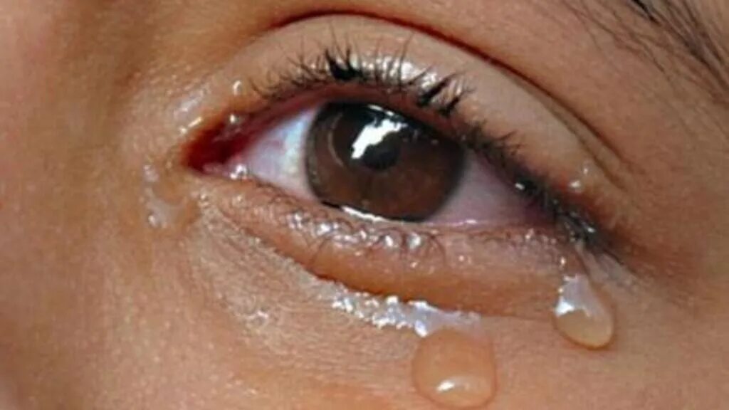 Слезотечение из глаз причины у взрослых. Карий глаз со слезой. Плачущие глаза. Плачущий глаз Карий. Глаза наполненные слезами.