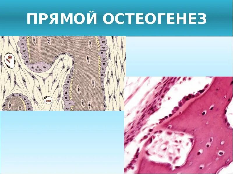 Прямой и непрямой остеогенез гистология. Непрямой остеогенез гистология препарат.