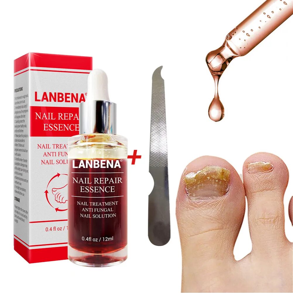 Средство от ногтевого грибка. Fungal treatment solution для ногтей. LANBENA Nail Repair Essence от грибка ногтей. Сыворотка для восстановления ногтей Nail fungal solution. LANBENA эссенция для ногтей.