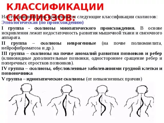 3 группа здоровья сколиоз. Группа здоровья с хроническими заболеваниями. Важность осанки. 3 группа здоровья сколиоз. Группы здоровья.