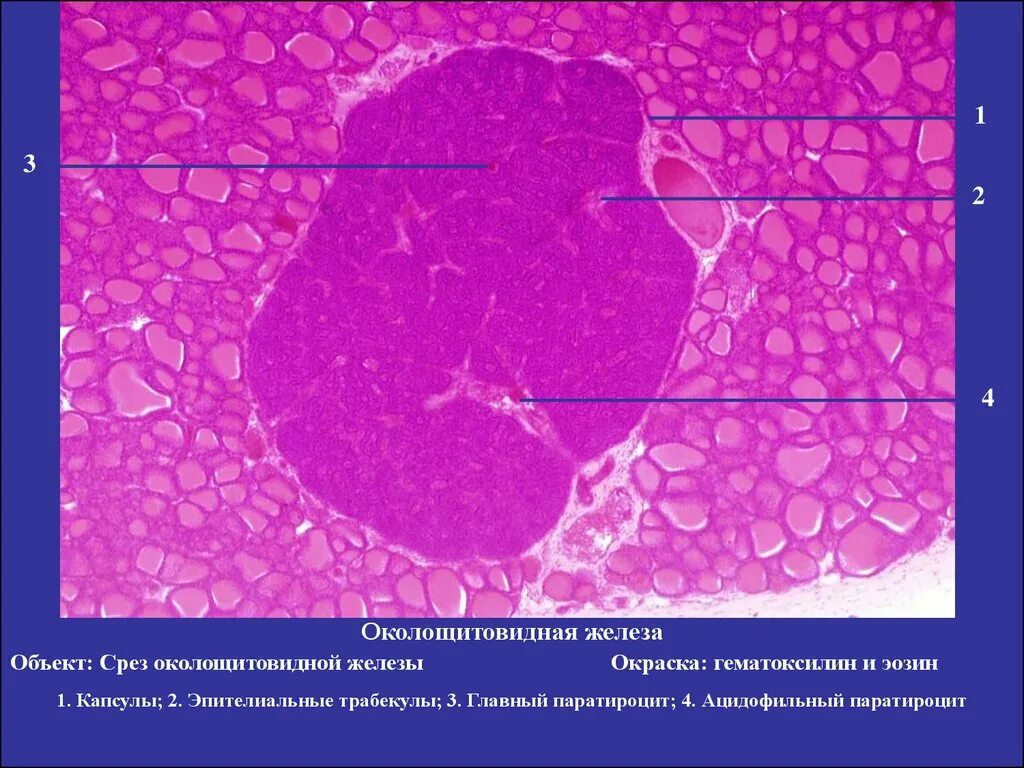 Паращитовидная железа гистология препарат. Околощитовидная железа окраска гематоксилин-эозин. Щитовидная железа окраска гематоксилином и эозином. Паращитовидная железа гематоксилин эозин.