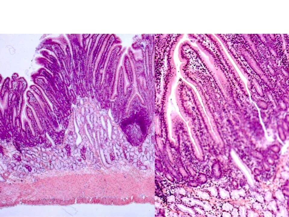 Препарат двенадцатиперстной кишки гистология. Препарат 12 перстная кишка кишка гистология. Двенадцатиперстная кишка гистология препарат. Тонкая кишка 12 перстная гистология. Слизистая оболочка 12 кишки