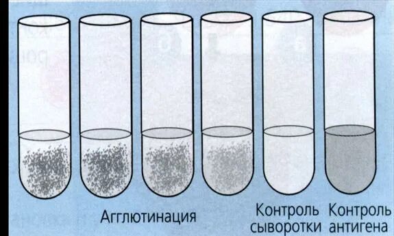 Развернутая реакция агглютинации микробиология. Развёрнутая реакция агглютинации микробиология. Развернутая реакция агглютинации Видаля. Реакция агглютинации микробиология. Методы реакции агглютинации