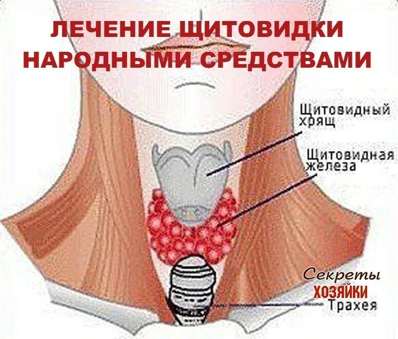 Исцеление щитовидной. Терапия щитовидной железы. Щитовидная железа лечится. Излечение щитовидной железы.