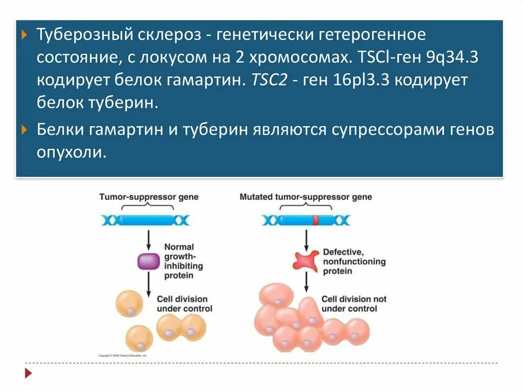 Туберкулезный склероз. Туберкулезный склероз