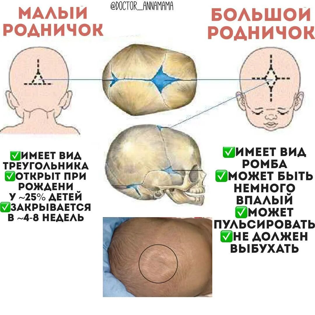 Сколько родничков у ребенка