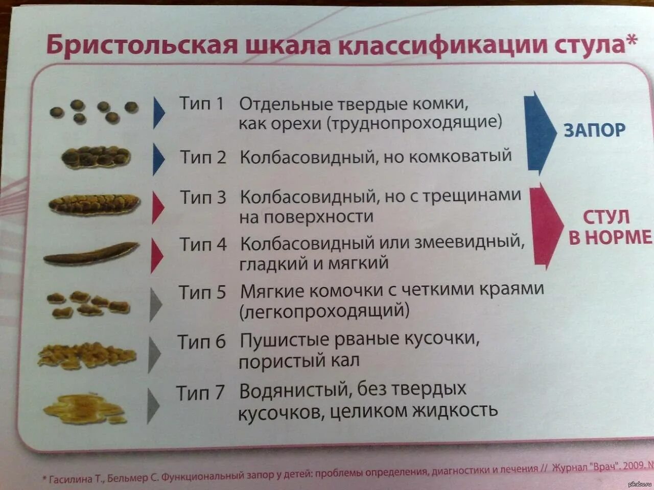 От чего может быть зеленый кал. Бристольская шкала кала запор. Бристольская шкала стула у детей. Бристольская шкала формы кала у детей. Бристольская шкала кала у грудничка.