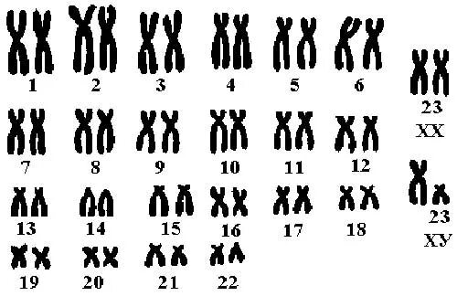 Хромосом группы d. Идиограмма кариотипа. Денверская классификация хромосом. Классификация хромосом человека таблица. Денверская классификация хромосом человека таблица.