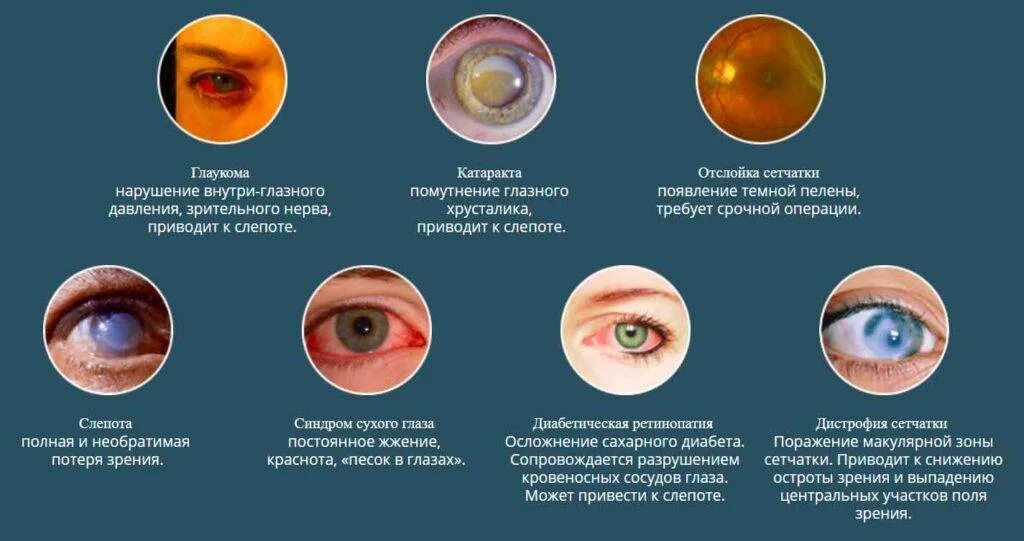 Ну шейка глазки. Нарушение зрения. Заболевания глаз со слепотой.