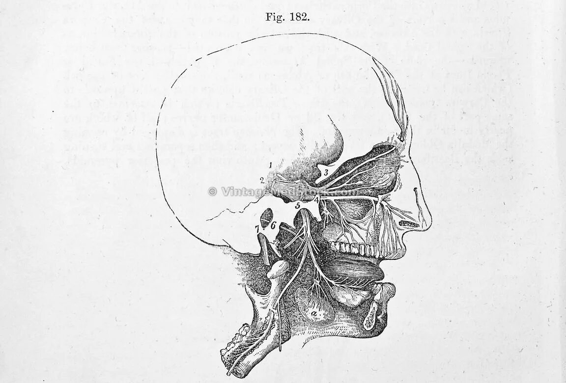 Лицевой нерв череп. Нервы черепа. Череп нервы рисунок. Зажим нерва под черепом. Все нервы черепа рисунок.