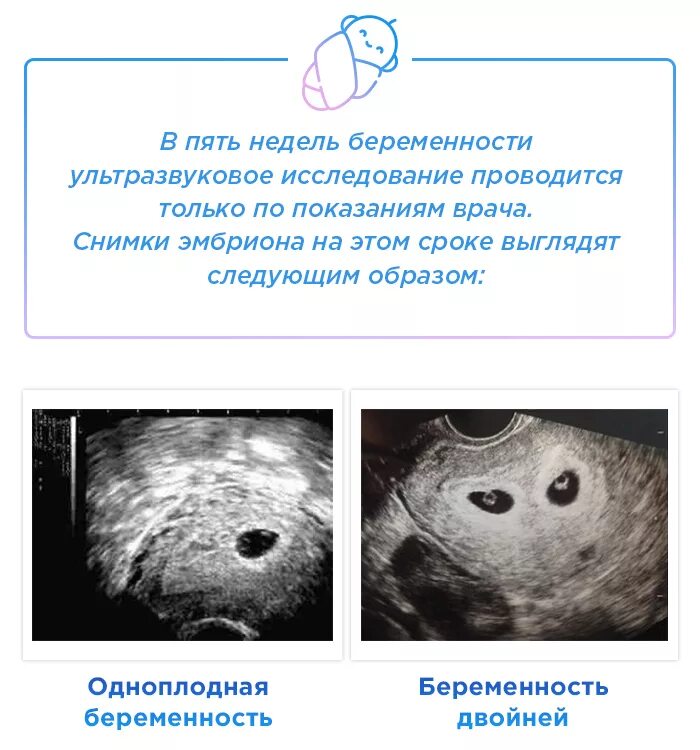 Аппетит на 5 неделе. Как выглядит эмбрион в 5-6 недель на УЗИ. Размер плода по УЗИ 5 недель. Беременность 5 недель УЗИ признаки. Эмбрион на 5 неделе беременности УЗИ.