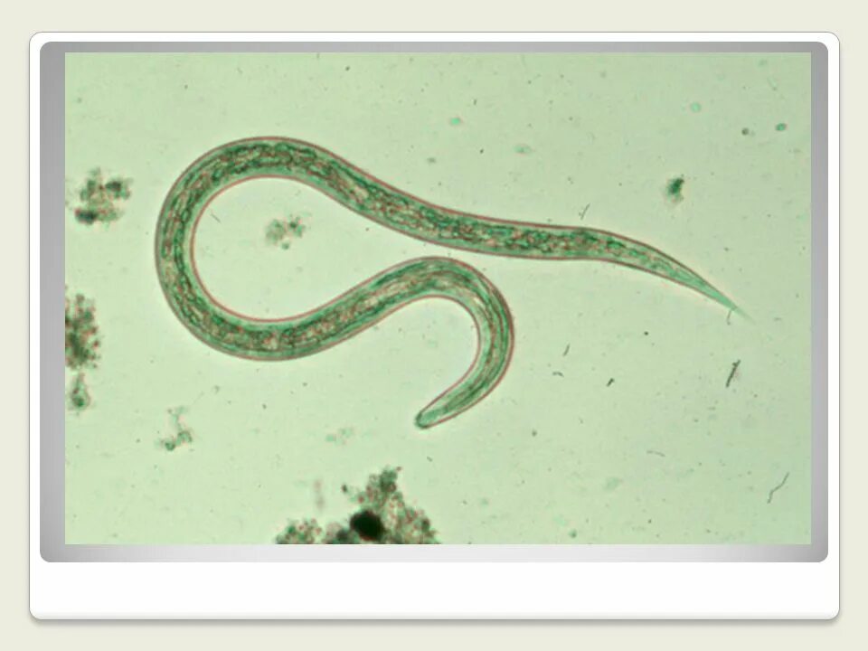 Анкилостома микроскоп. Анкилостома паразитология. Круглые черви анкилостомы. Круглые черви заболевания