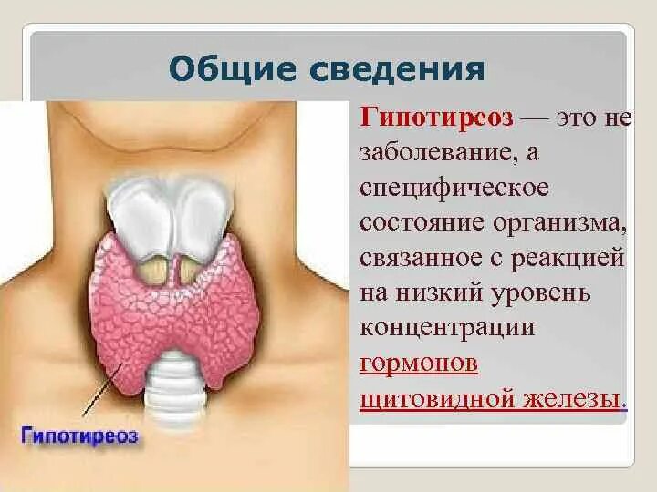 Щитовидная железа гипофункция и гиперфункция. Желудочно – кишечный тракт при тиреотоксикозе. Гипертиреоз щитовидной железы. Гипотиреоз первичный вторичный третичный. Гипертиреоз щитовидной железы симптомы.