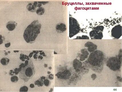 Самара бруцеллез
