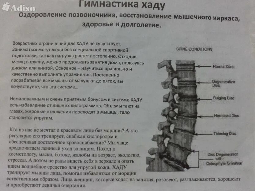 После операции на позвоночнике дают инвалидность. Протрузии дисков поясничного отдела симптомы. Что такое протрузия дисков позвоночника поясничного отдела. Протрузия шейного отдела позвоночника. Остеохондроз поясничного отдела и протрузия позвонков.