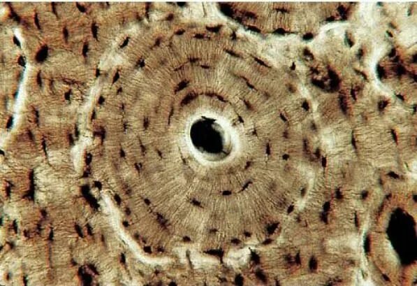 Срез кости. Костная ткань в микроскопе. Костная ткань микрофотография. Остеон микроскоп. Костная ткань микропрепарат.