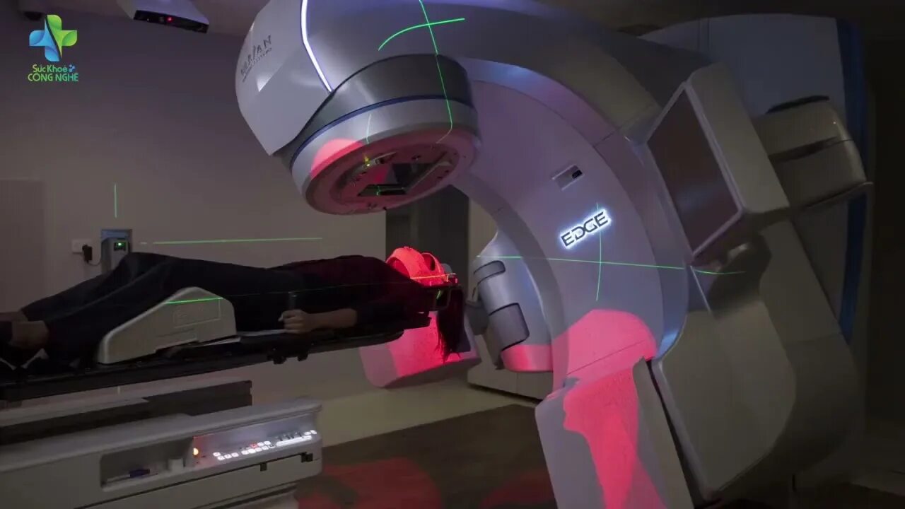 Лучевая терапия курс лечения. Imrt radiation therapy. 3d-конформная лучевая терапия сингапур. imrt лучевая терапия. гамма излучение лучевая терапия.