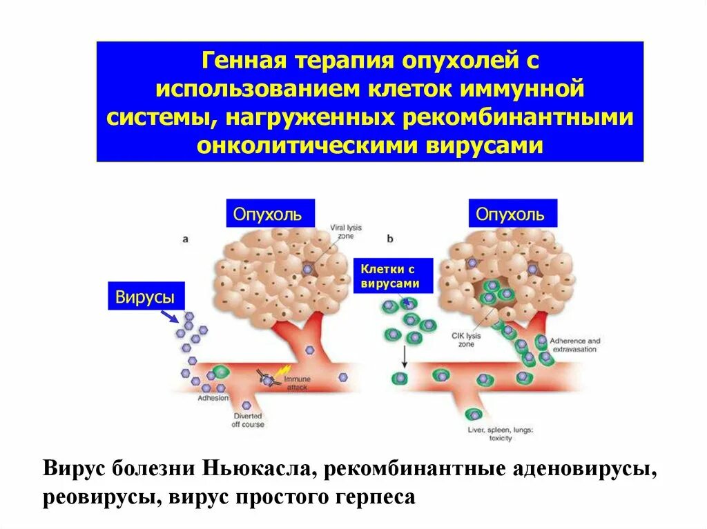 Терапия опухолей. Опухолевые заболевания и генная терапия. Опухоли иммунной системы. Вирусы опухоли