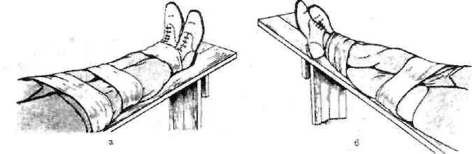 Перелом голени транспортировка. Иммобилизация при переломе бедренной кости. Транспортная иммобилизация при переломе костей голени бедра. Перелом бедра шина Дитерихса. Иммобилизация при переломе костей голени и бедра.