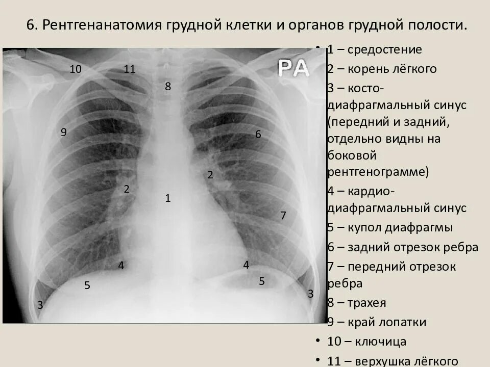 Ээд легких