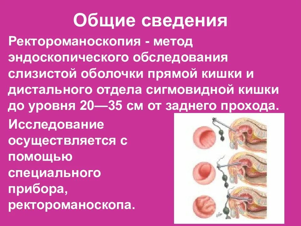 Ректороманоскоп используется для осмотра слизистой оболочки. Ректороскопия ободочной кишки. ректороманоскопия (ректоскопия). ректороманоскопия памятка.