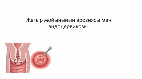 Әдемі әйелдер сексуальный порно тромб Ресей