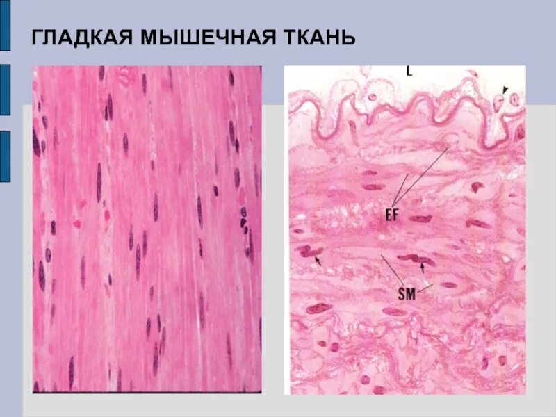 Скелетная мускулатура гистология. Гладкая мускулатура гистология. Гладкая мышечная ткань микропрепарат. Гладкая мышечная ткань гистология.