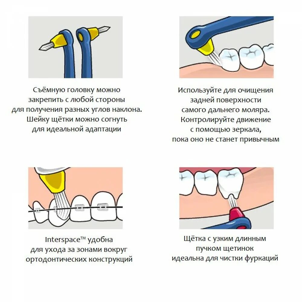 Как чистить монопучковой щеткой. Памятка чистки зубов с брекетами. Схема как чистить зубы электрической щеткой. Схема чистки зубов щёткой для брекетов.