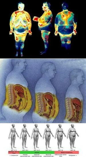 Как выглядит жир в теле человека. Висцеральный жир на органах. анатомия висцерального жира человека. висцеральный жир на сердце. избыток висцерального жира.