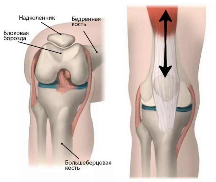 Надколенник коленного сустава анатомия. Надколенник Patella. Хондромаляция надколенника коленного сустава. Хондромаляция надколенника 4 степени.