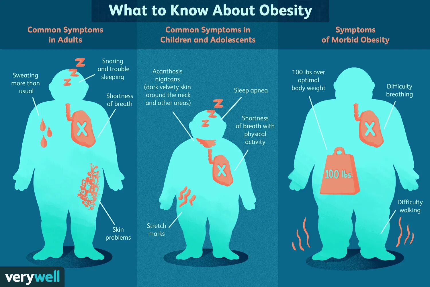 Ожирение. Obesity is a problem рисунки. Lead to obesity. Ожирение внутренних органов. Obesity-associated morbidity.