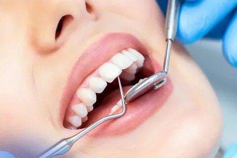 Dentist teeth