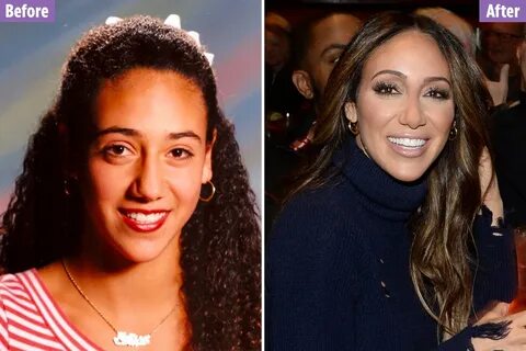 Melissa gorga before and after plastic surgery